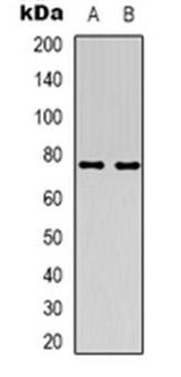 Western blot analysis of ACSS1 expression in HT29 (Lane 1), Jurkat (Lane 2) whole cell lysates using ACSS1 antibody