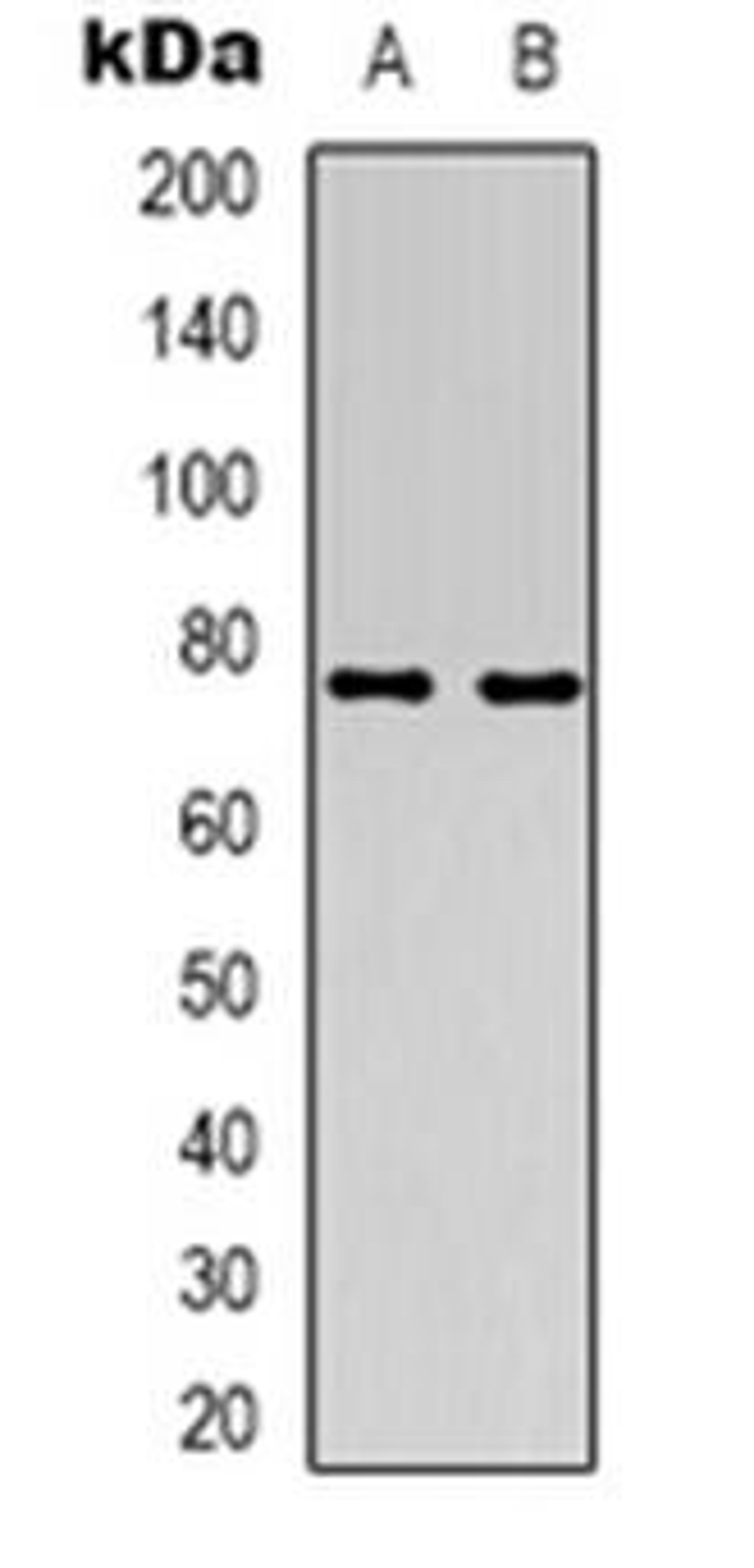 Western blot analysis of ACSS1 expression in HT29 (Lane 1), Jurkat (Lane 2) whole cell lysates using ACSS1 antibody