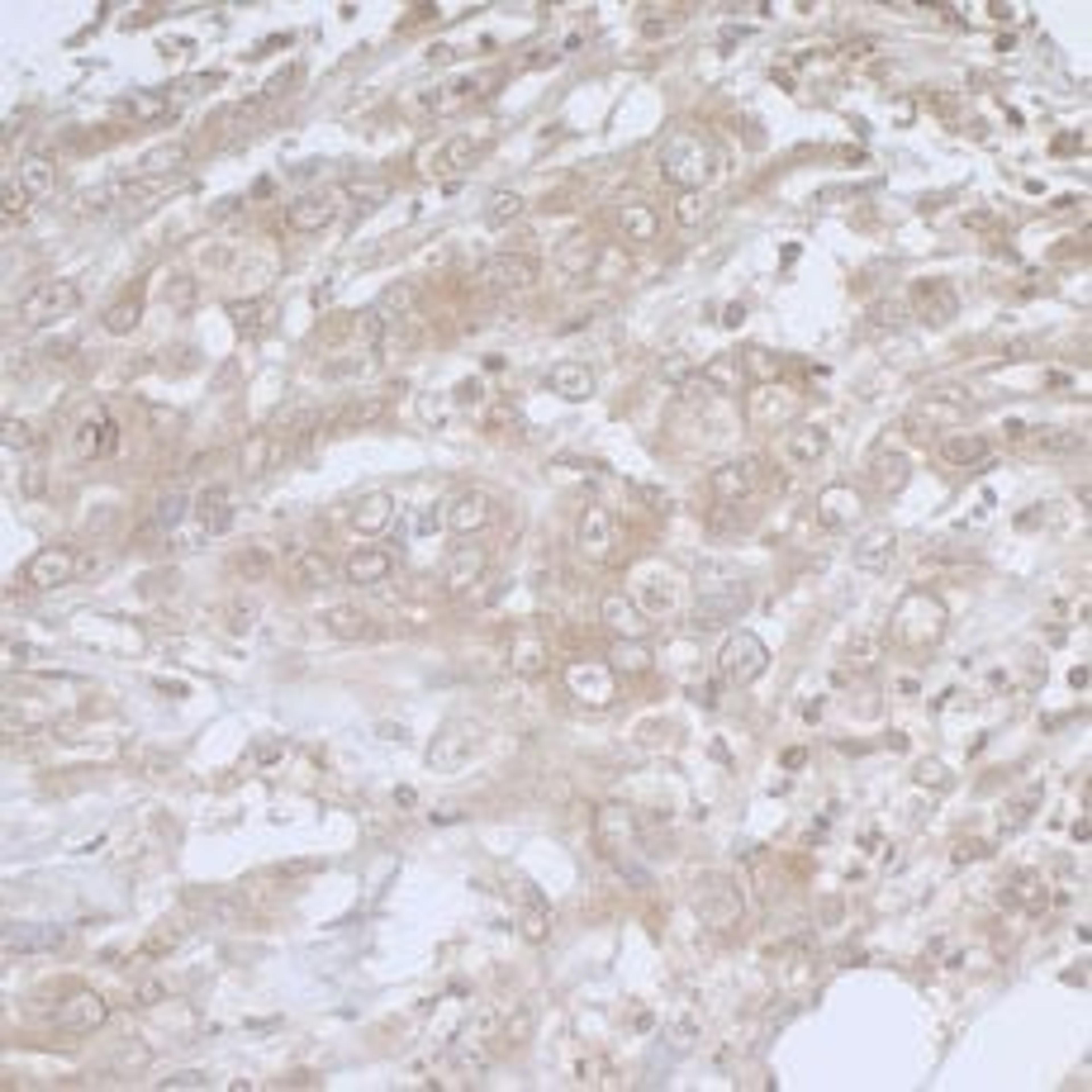 Detection of human BIRC6/Apollon by immunohistochemistry.