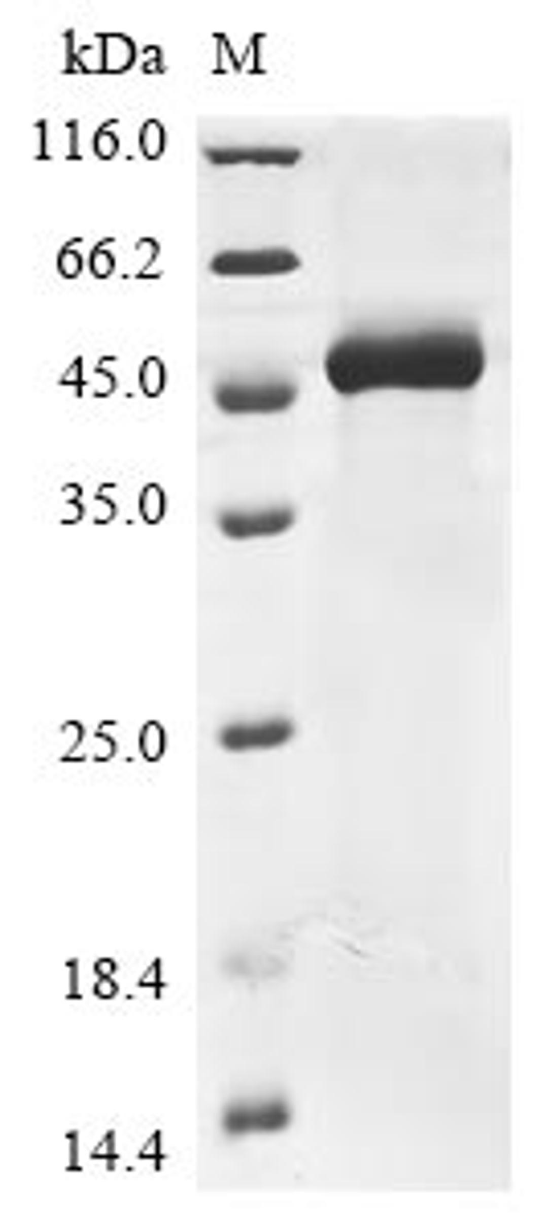 (Tris-Glycine gel) Discontinuous SDS-PAGE (reduced) with 5% enrichment gel and 15% separation gel.