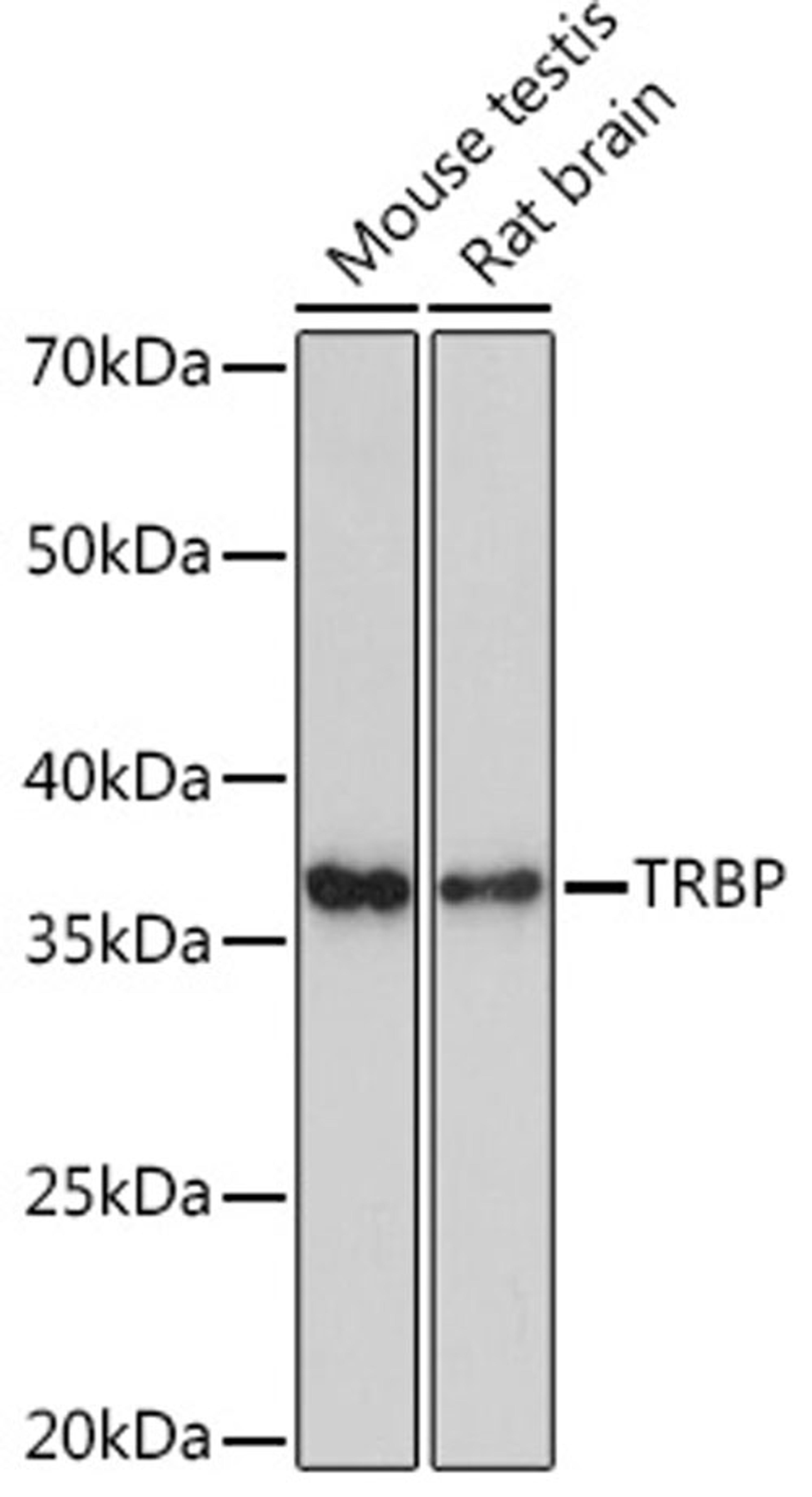 Western blot - TRBP Rabbit mAb (A9105)