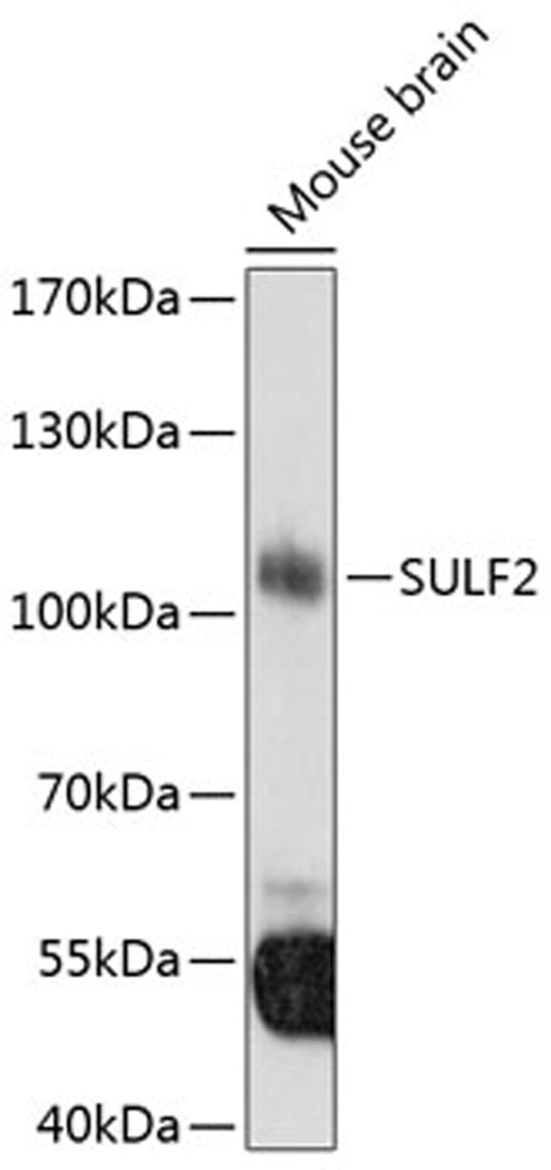 Western blot - SULF2 antibody (A8803)