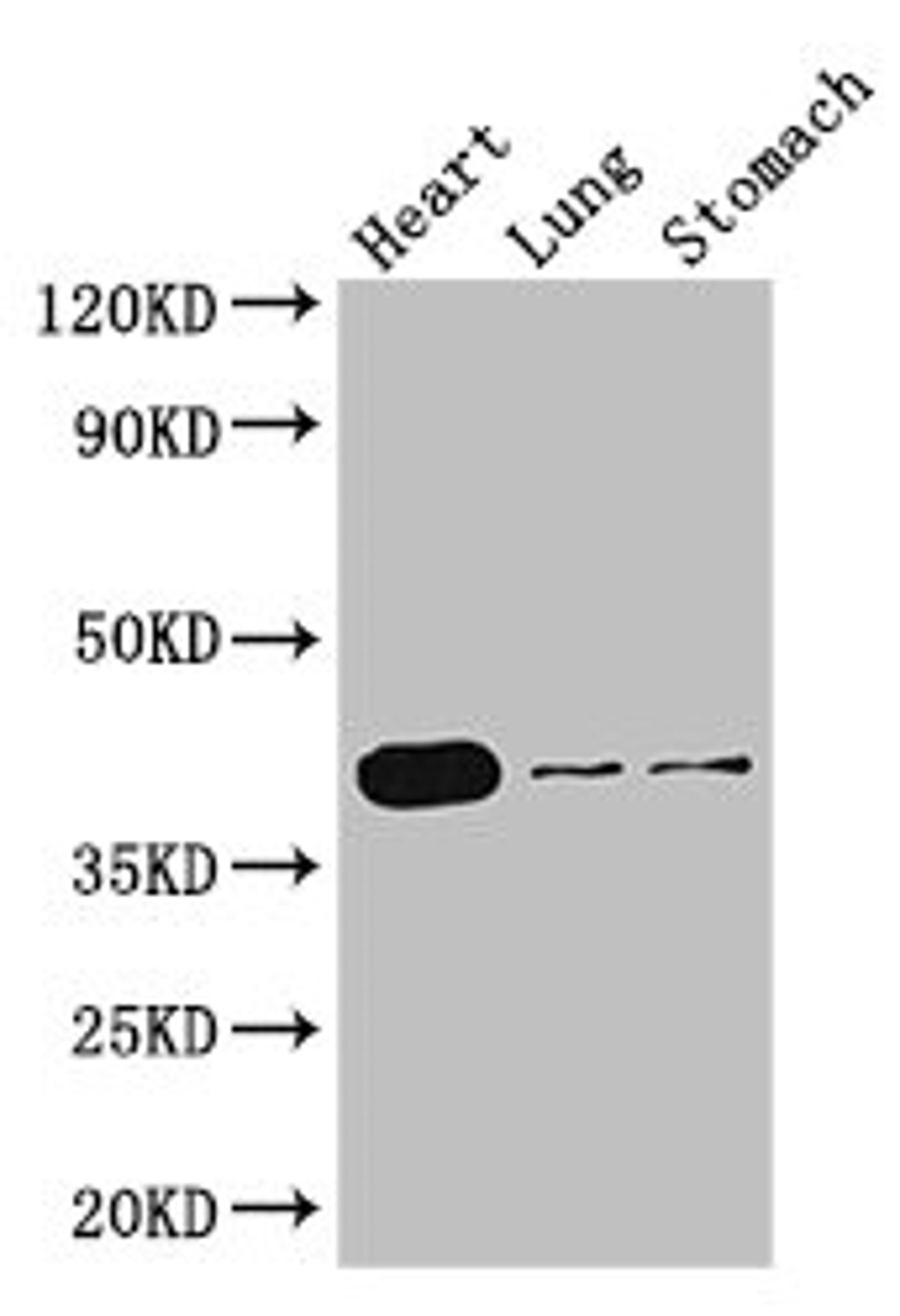 Western Blot. Positive WB detected in: Mouse heart tissue, Mouse lung tissue, Mouse stomach tissue. All lanes: DMRT1 antibody at 3ug/ml. Secondary. Goat polyclonal to rabbit IgG at 1/50000 dilution. Predicted band size: 40, 29, 19 kDa. Observed band size: 40 kDa. 