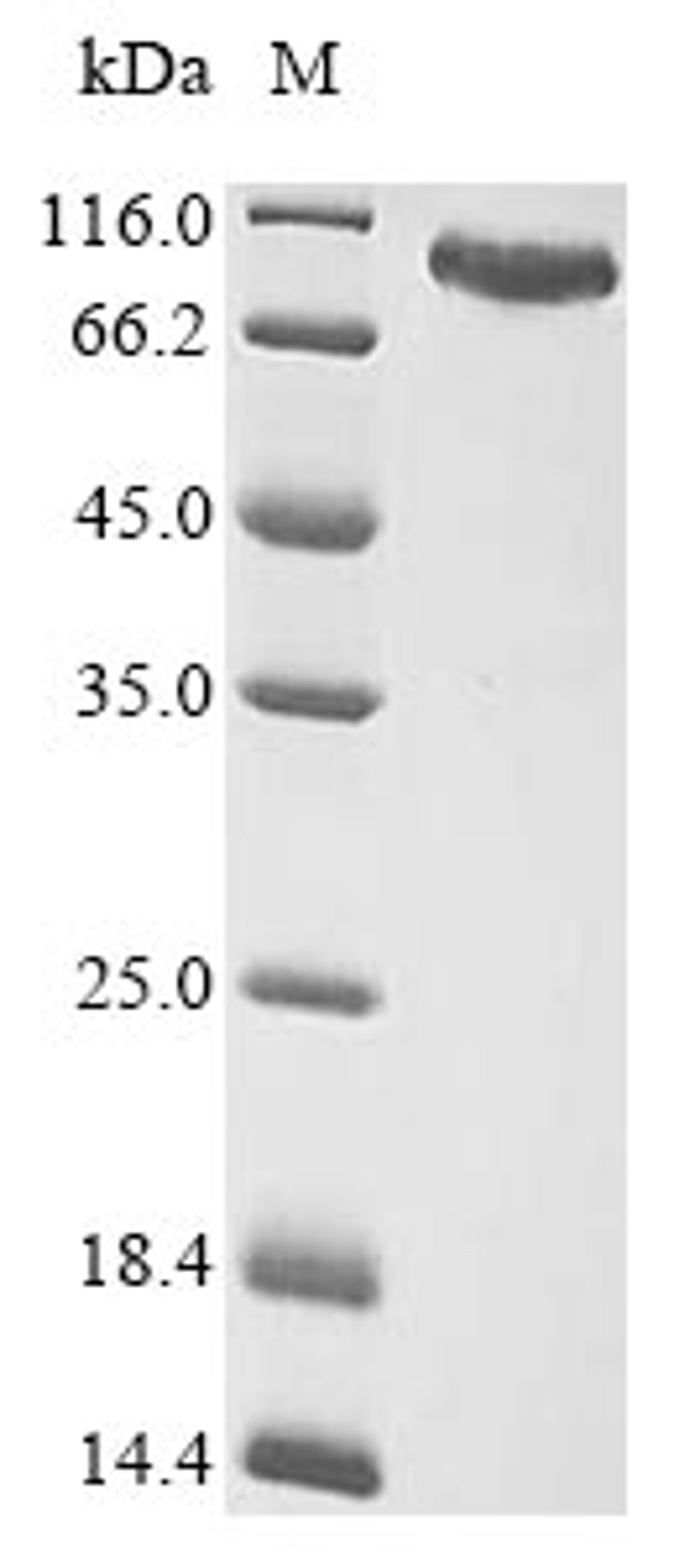(Tris-Glycine gel) Discontinuous SDS-PAGE (reduced) with 5% enrichment gel and 15% separation gel.