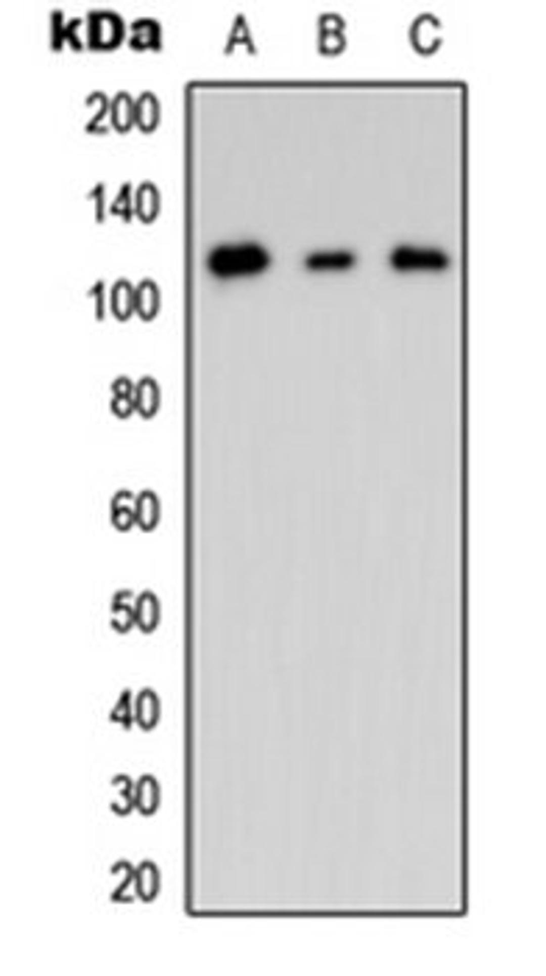 Western blot analysis of HEK293T (Lane 1), mouse Brain (Lane 2), rat brain (Lane 3) whole cell lysates using CNK2 antibody