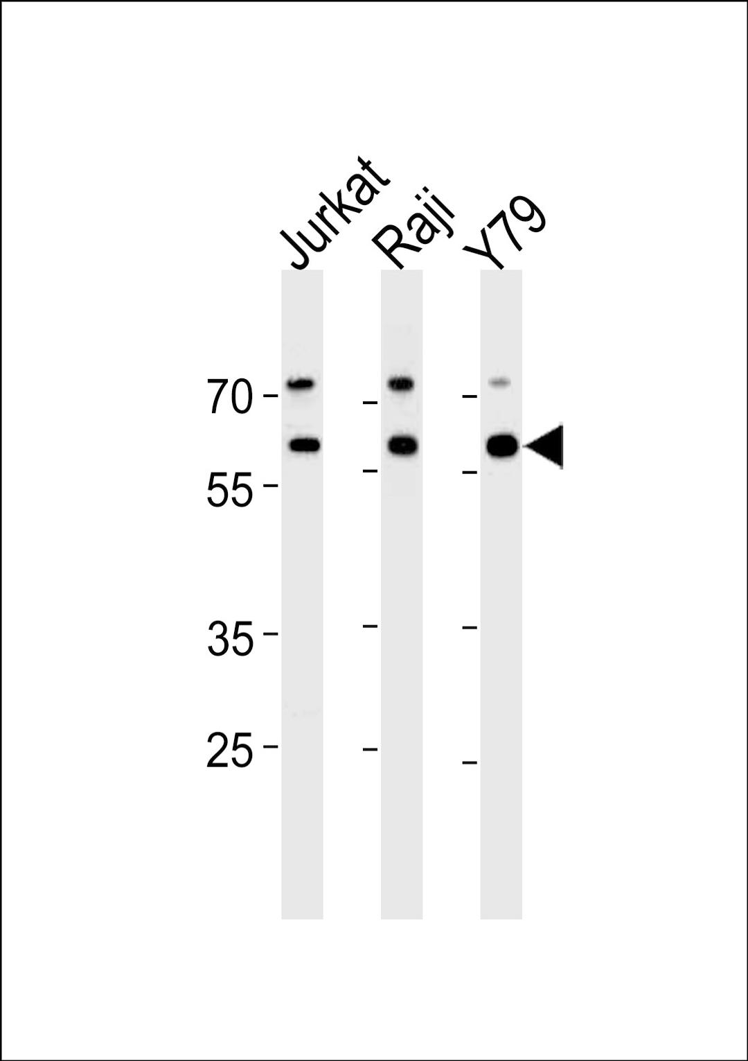 Western blot analysis in Jurkat,Raji,Y79 cell line lysates (35ug/lane).