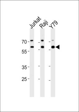 Western blot analysis in Jurkat,Raji,Y79 cell line lysates (35ug/lane).