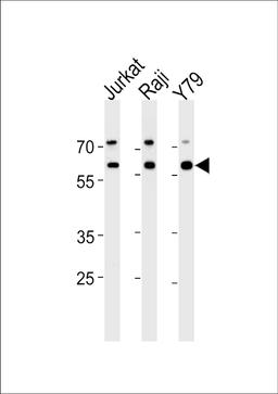 Western blot analysis in Jurkat,Raji,Y79 cell line lysates (35ug/lane).
