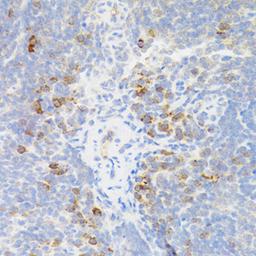 Immunohistochemistry - TNFRSF13B antibody (A5658)