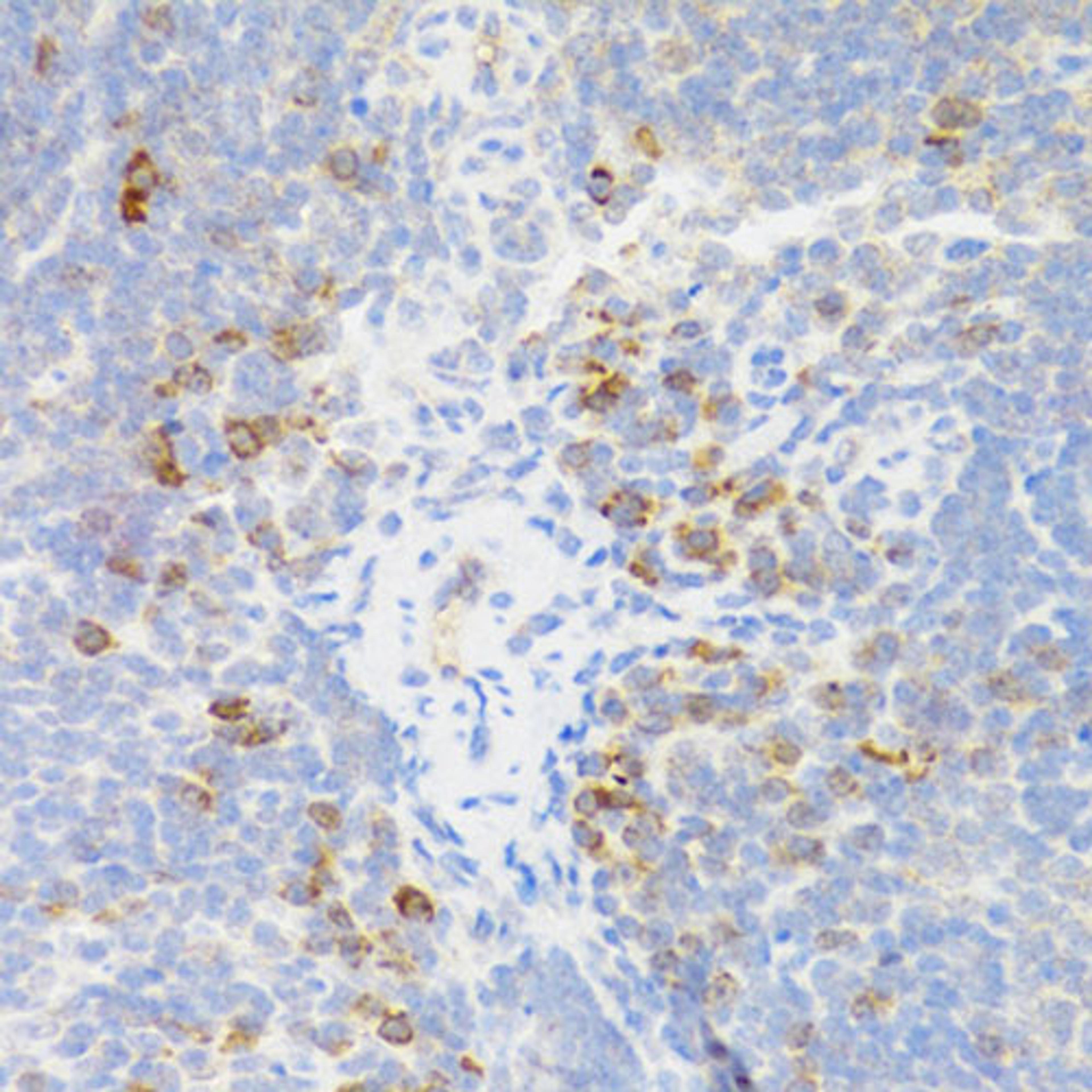 Immunohistochemistry - TNFRSF13B antibody (A5658)