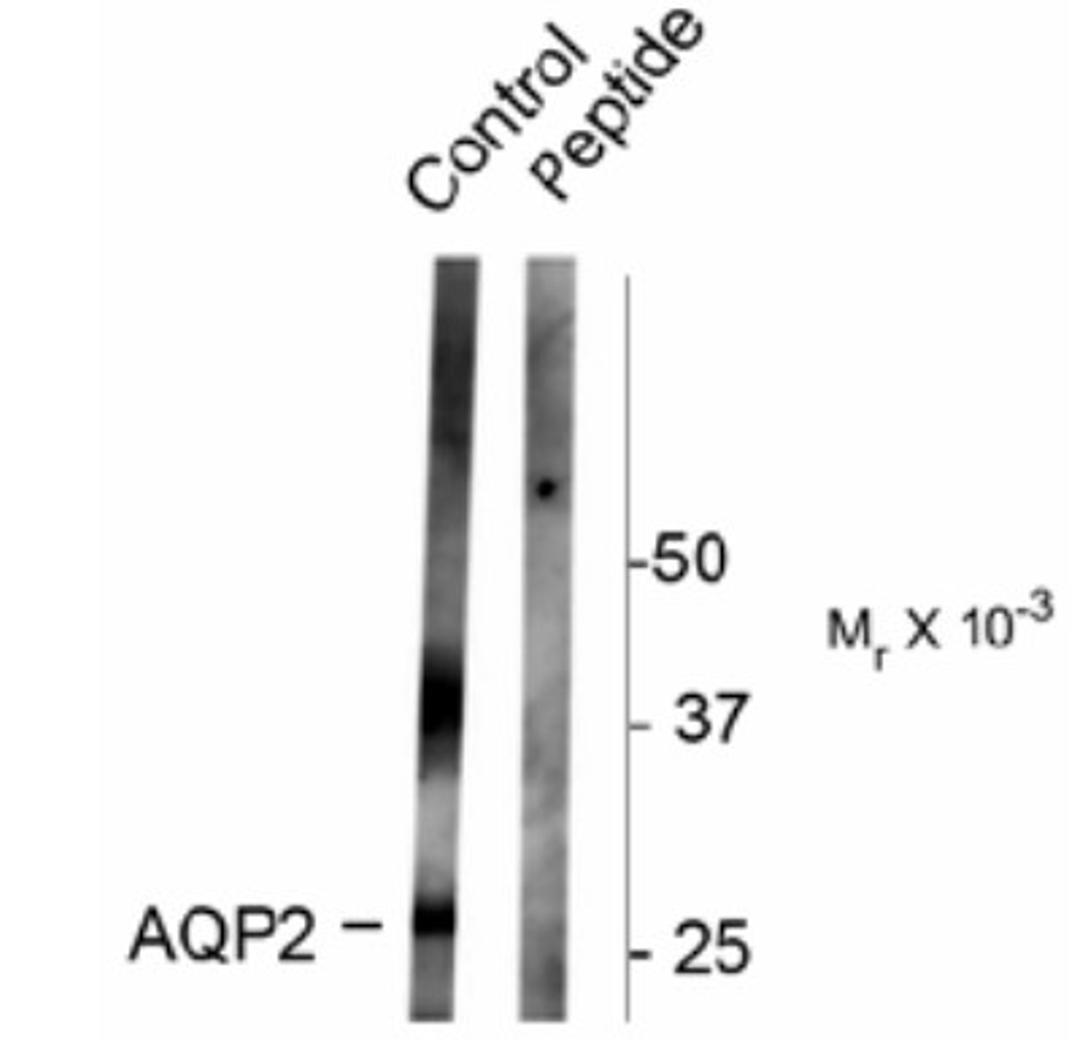 Western Blot: Aquaporin-2 [p Ser261] Antibody [NB100-61100] - Rat kidney lysate showing specific immunolabeling of the ~ 29k and 37k glycosylated form of the AQP2 protein phosphorylated at Ser261. Immunolabeling is blocked by the phospho-peptide used as antigen (peptide) but not by the corresponding dephospho-peptide (not shown).