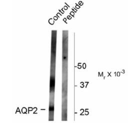 Western Blot: Aquaporin-2 [p Ser261] Antibody [NB100-61100] - Rat kidney lysate showing specific immunolabeling of the ~ 29k and 37k glycosylated form of the AQP2 protein phosphorylated at Ser261. Immunolabeling is blocked by the phospho-peptide used as antigen (peptide) but not by the corresponding dephospho-peptide (not shown).