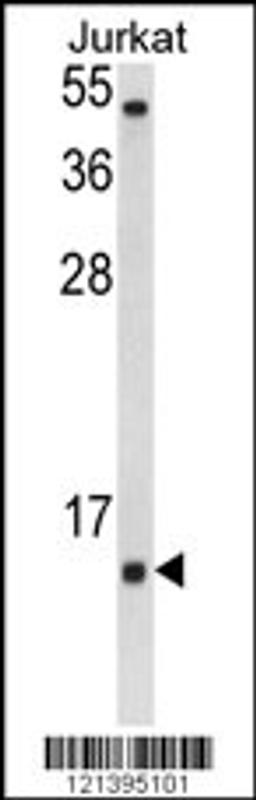 Western blot analysis of SOD1 Antibody in Jurkat cell line lysates (35ug/lane)