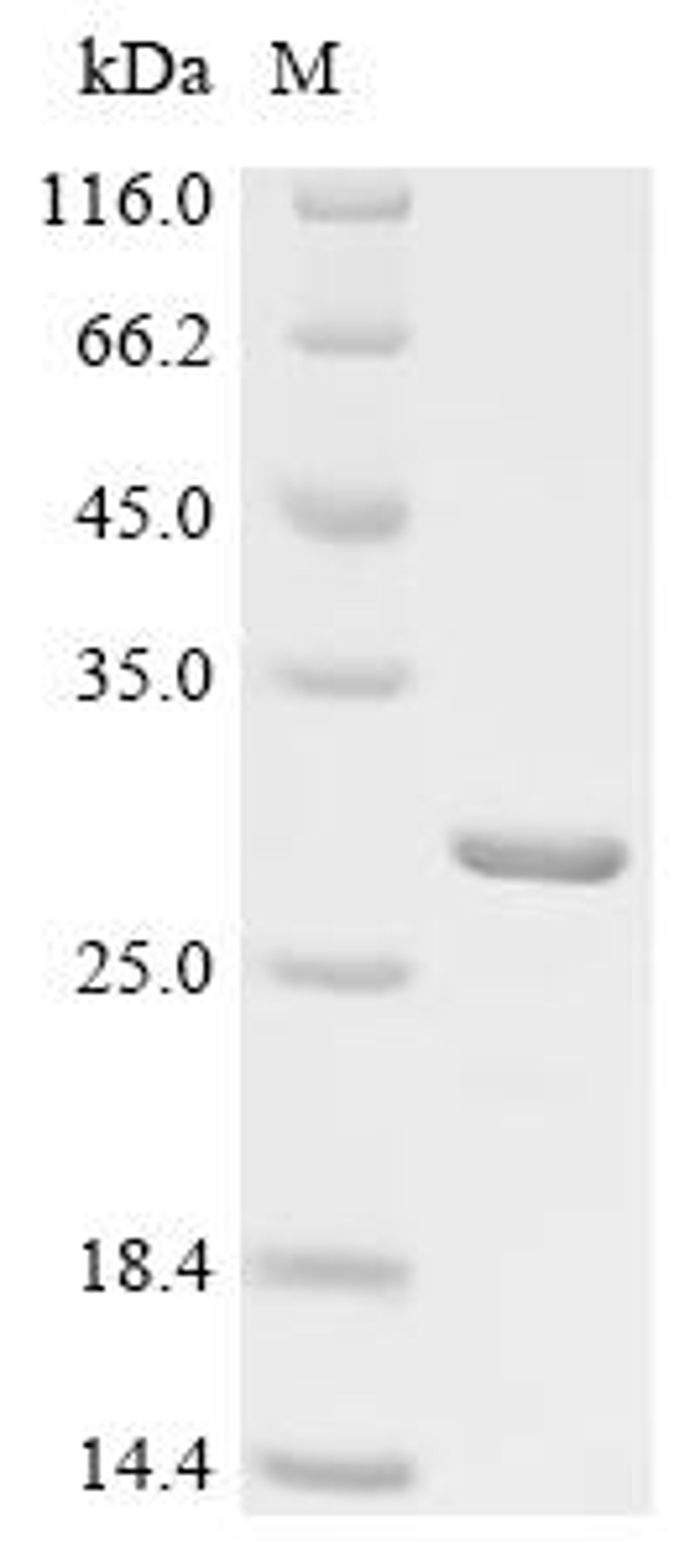 (Tris-Glycine gel) Discontinuous SDS-PAGE (reduced) with 5% enrichment gel and 15% separation gel.