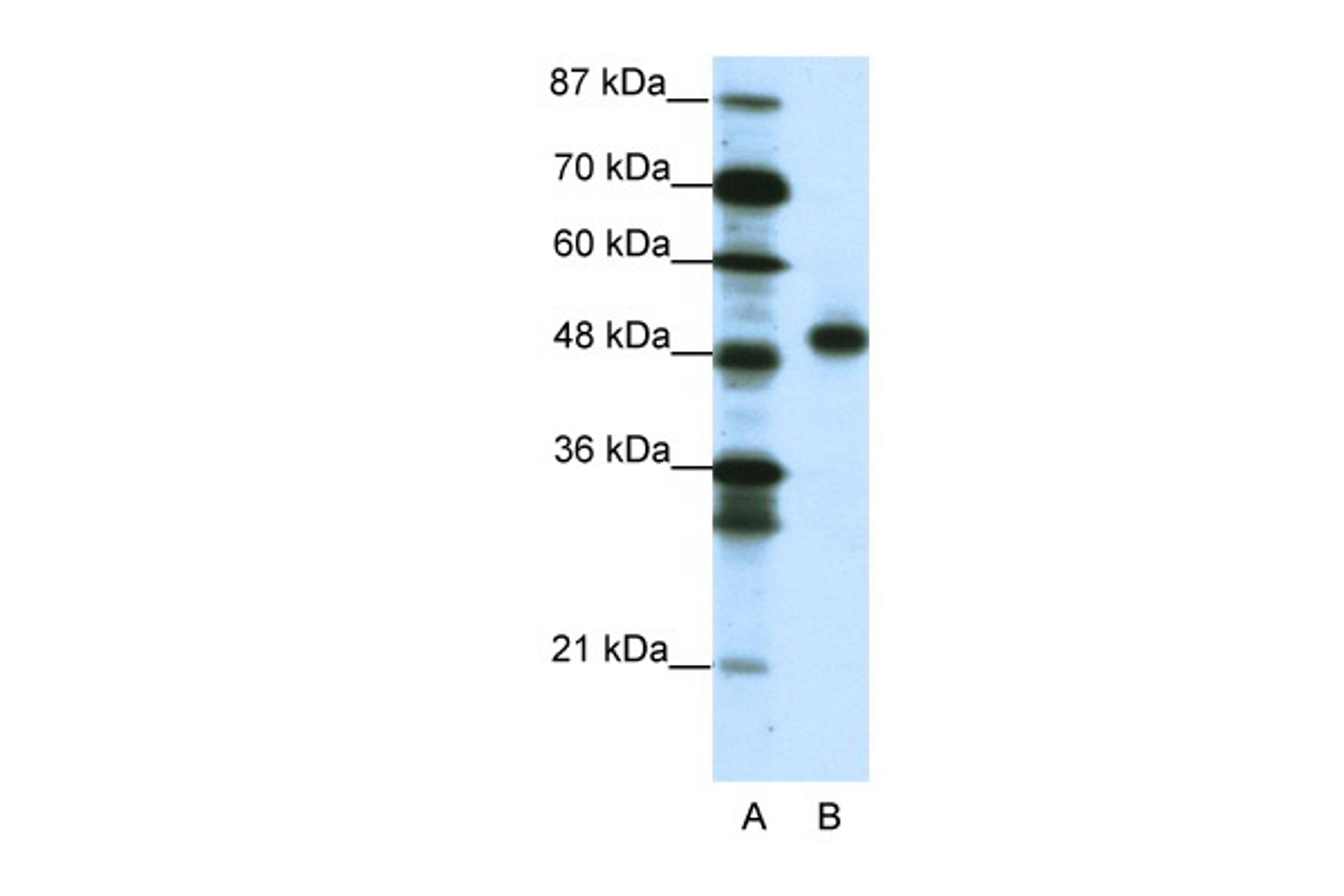 Antibody used in WB on Human Jurkat 1.25 ug/ml.