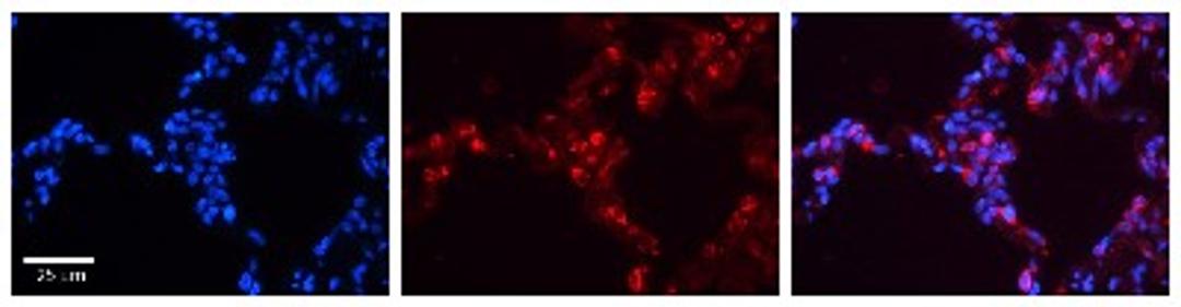 Immunohistochemistry: Surfactant Protein B Antibody [NBP1-57977] - Human Lung Tissue Observed Staining: Cytoplasm and membrane of pneumocytes Primary Antibody Concentration: 1 : 600 Secondary Antibody: Donkey anti-Rabbit-Cy3 Secondary Antibody Concentration: 1 : 200 Magnification: 20X Exposure Time: 0.5 - 2.0 sec.