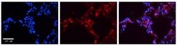 Immunohistochemistry: Surfactant Protein B Antibody [NBP1-57977] - Human Lung Tissue Observed Staining: Cytoplasm and membrane of pneumocytes Primary Antibody Concentration: 1 : 600 Secondary Antibody: Donkey anti-Rabbit-Cy3 Secondary Antibody Concentration: 1 : 200 Magnification: 20X Exposure Time: 0.5 - 2.0 sec.