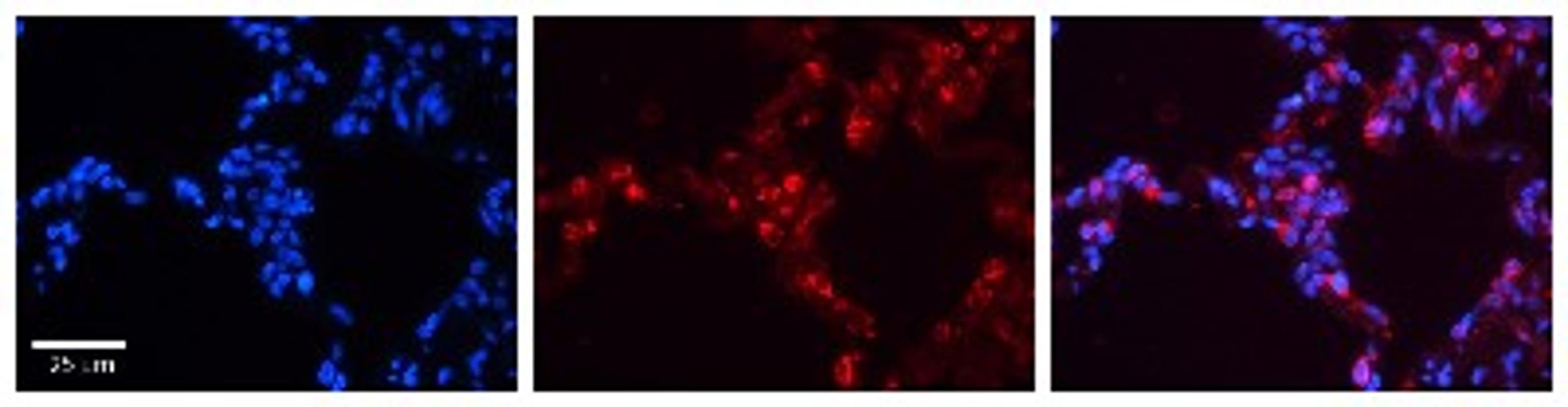 Immunohistochemistry: Surfactant Protein B Antibody [NBP1-57977] - Human Lung Tissue Observed Staining: Cytoplasm and membrane of pneumocytes Primary Antibody Concentration: 1 : 600 Secondary Antibody: Donkey anti-Rabbit-Cy3 Secondary Antibody Concentration: 1 : 200 Magnification: 20X Exposure Time: 0.5 - 2.0 sec.