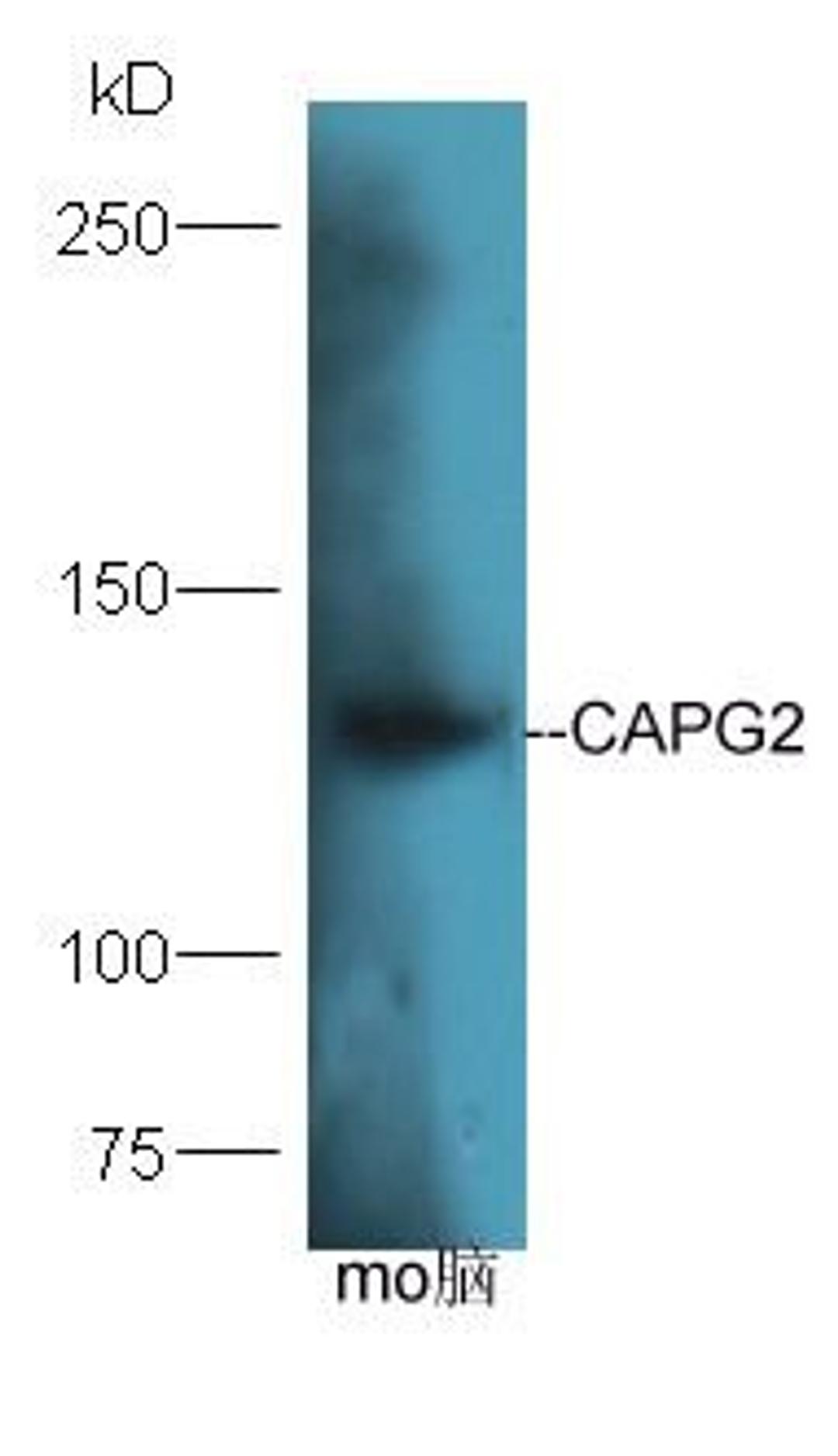 Western blot analysis of mouse brain lysates using CAPG2 antibody