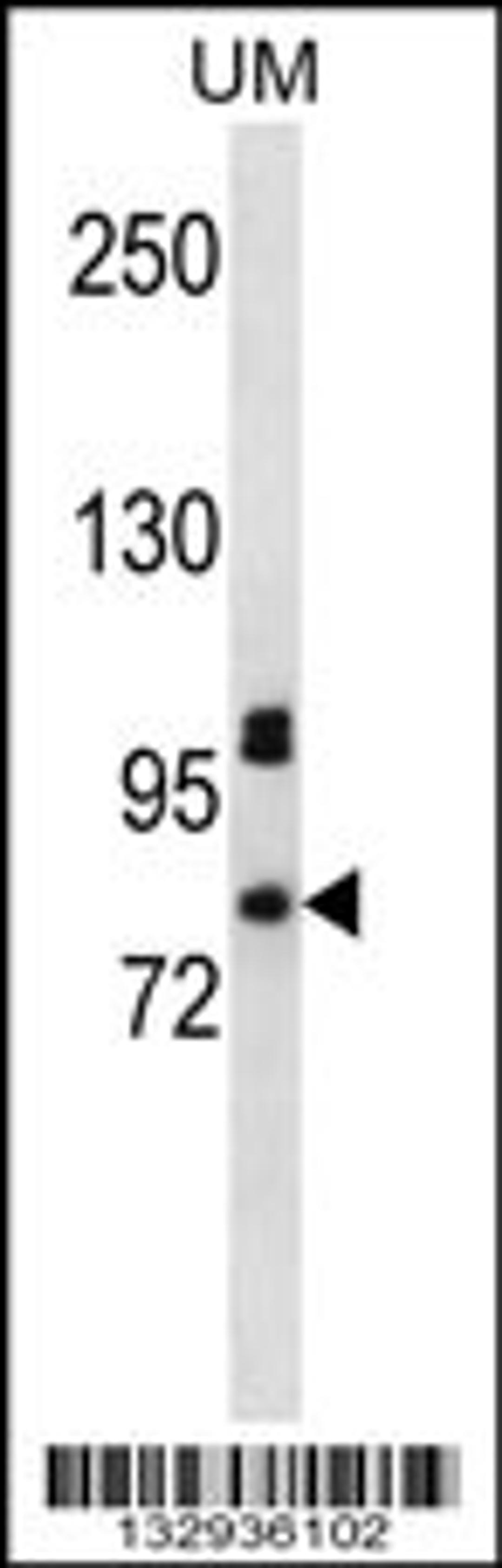 Western blot analysis in uterine tumor cell line lysates (35ug/lane).