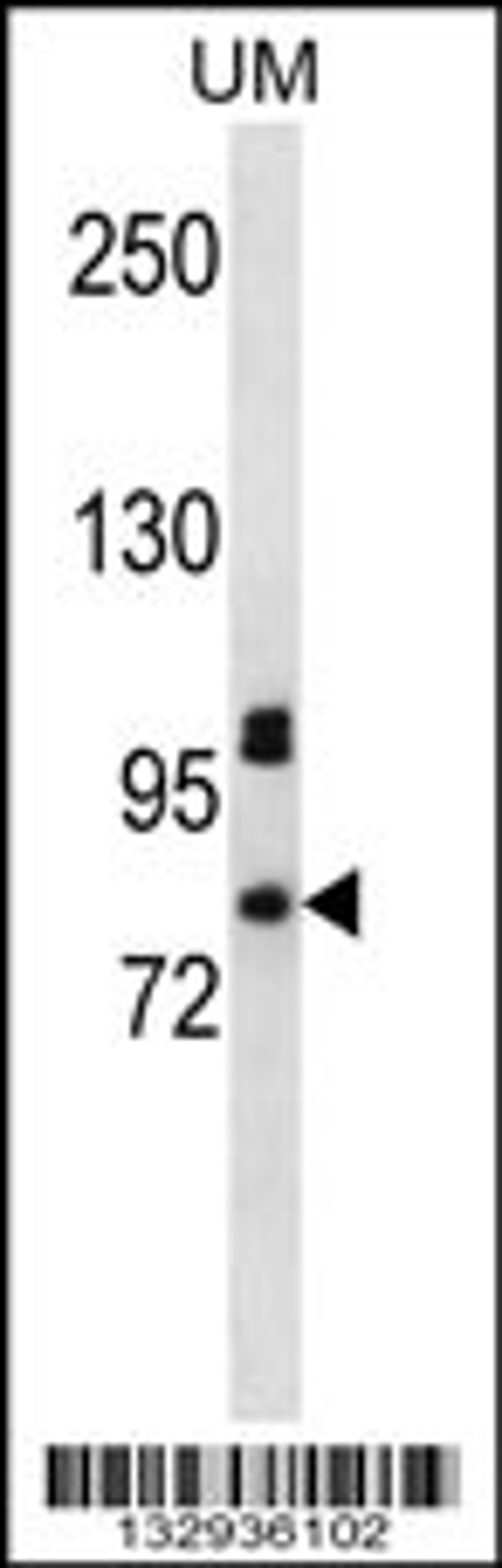 Western blot analysis in uterine tumor cell line lysates (35ug/lane).