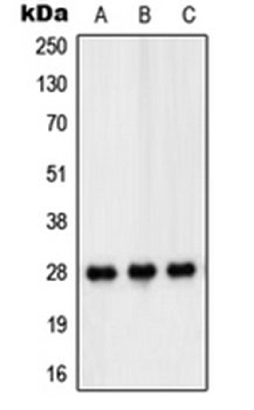 Western blot analysis of HT29 (Lane 1), THP1 (Lane 2), Jurkat (Lane 3) whole cell lysates using PEX11B antibody