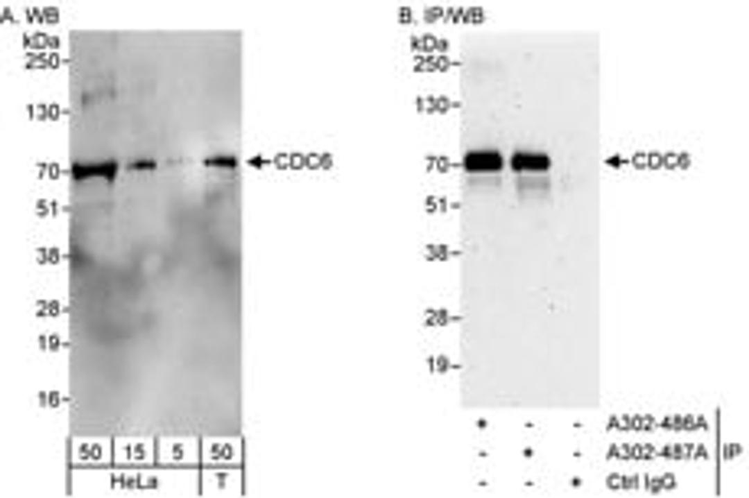 Detection of human CDC6 by western blot and immunoprecipitation.