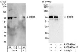 Detection of human CDC6 by western blot and immunoprecipitation.