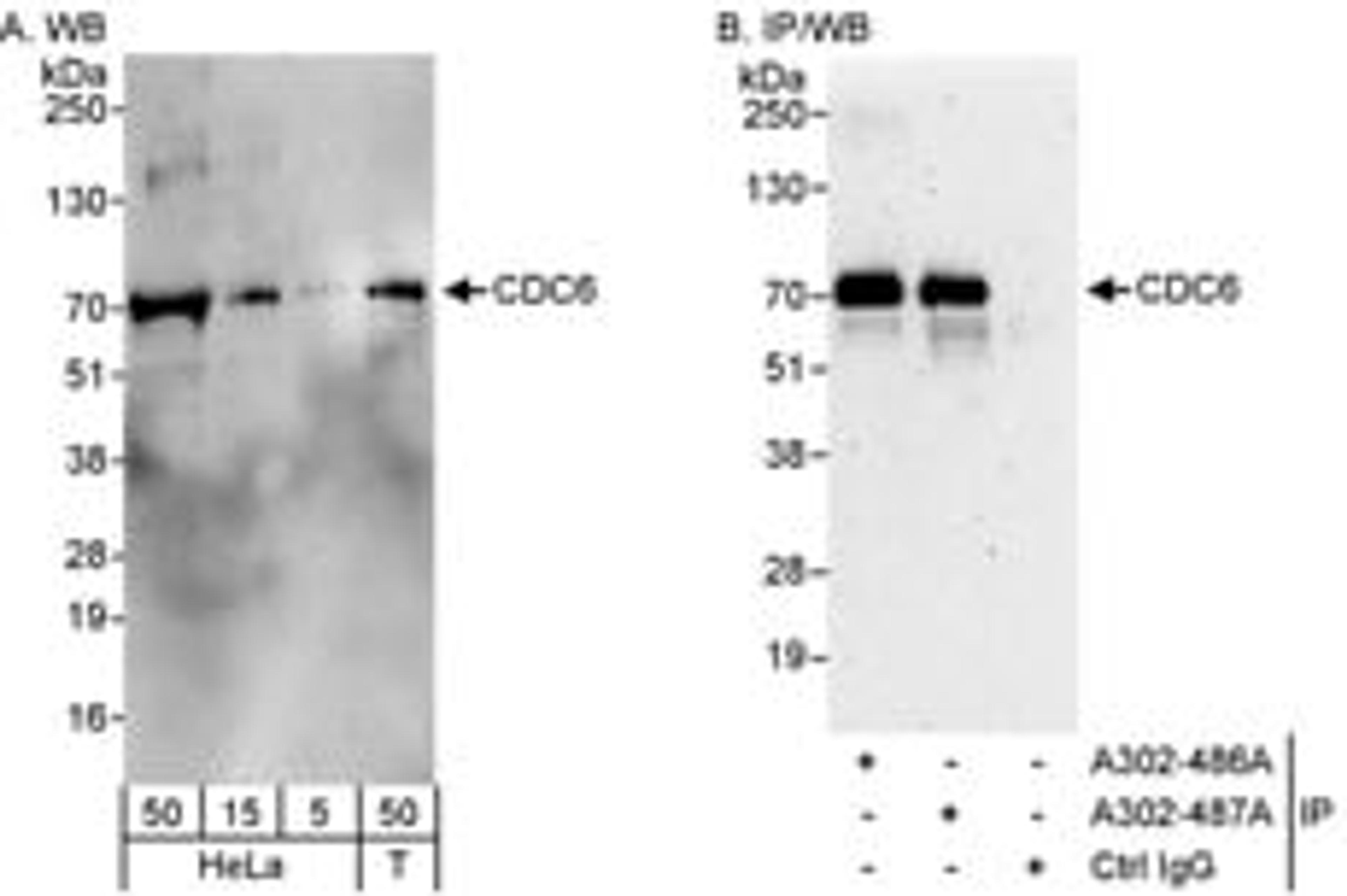 Detection of human CDC6 by western blot and immunoprecipitation.