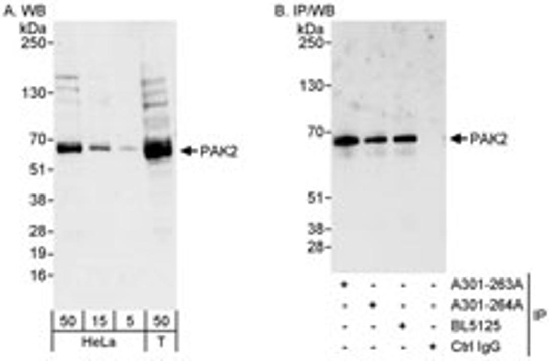 Detection of human PAK2 by western blot and immunoprecipitation.