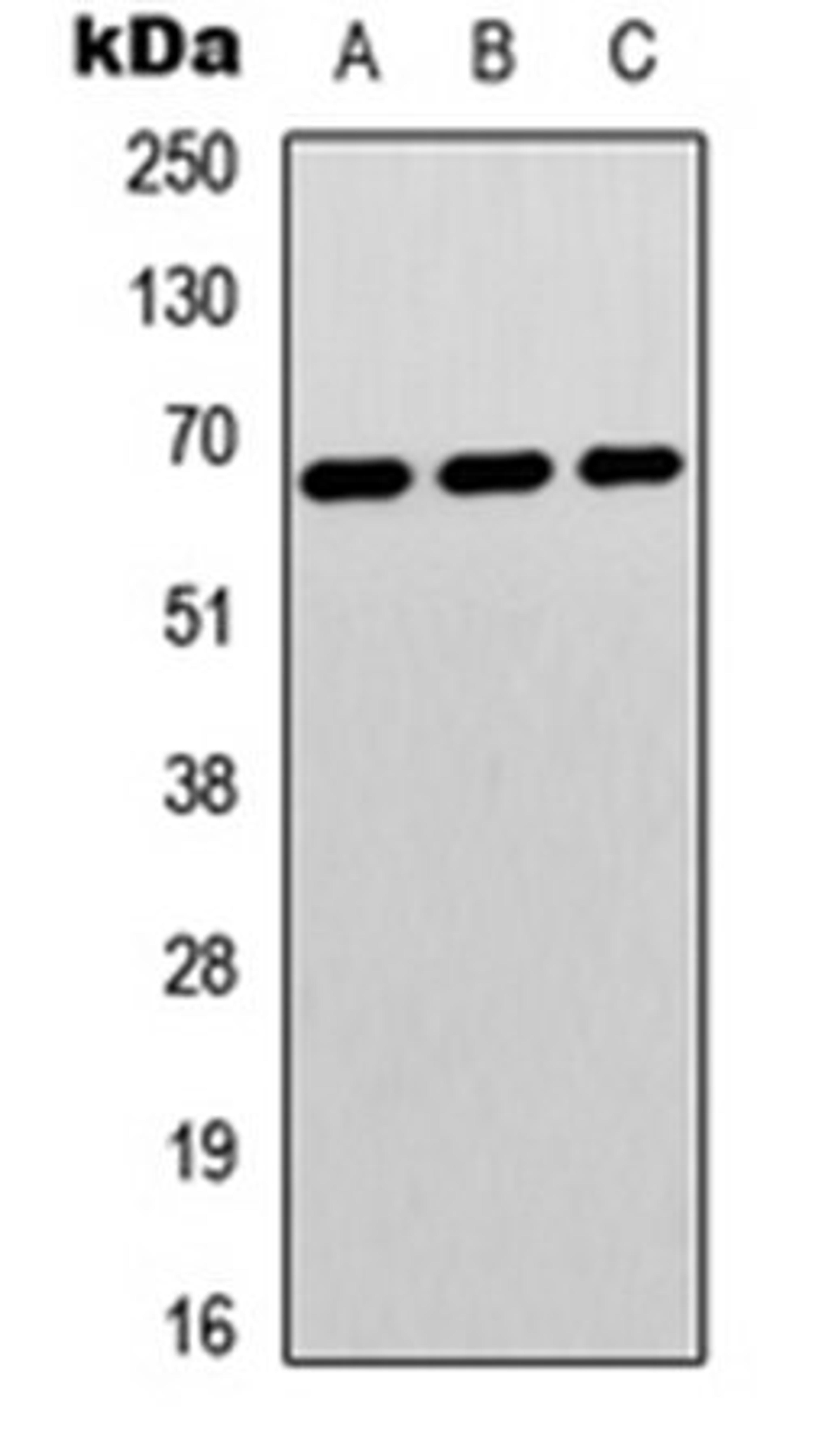 Western blot analysis of Jurkat (Lane 1), Hela (Lane 2), human brain (Lane 3) whole cell lysates using p67 antibody