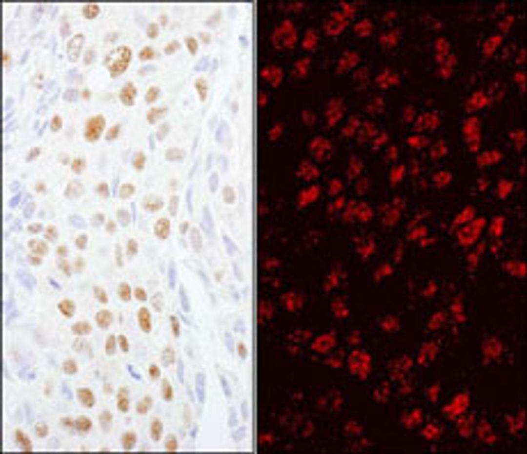 Detection of human ZCCHC8 by immunohistochemistry.