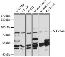 Western blot - SLC27A4 antibody (A16102)