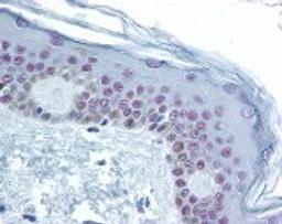 Immunohistochemistry staining of CREB1 in skin tissue using CREB1 Antibody.