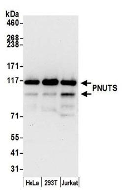 Detection of human PNUTS by western blot.