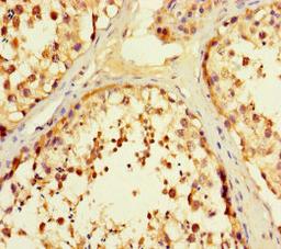 Immunohistochemistry of paraffin-embedded human testis tissue using CSB-PA007924LA01HU at dilution of 1:100