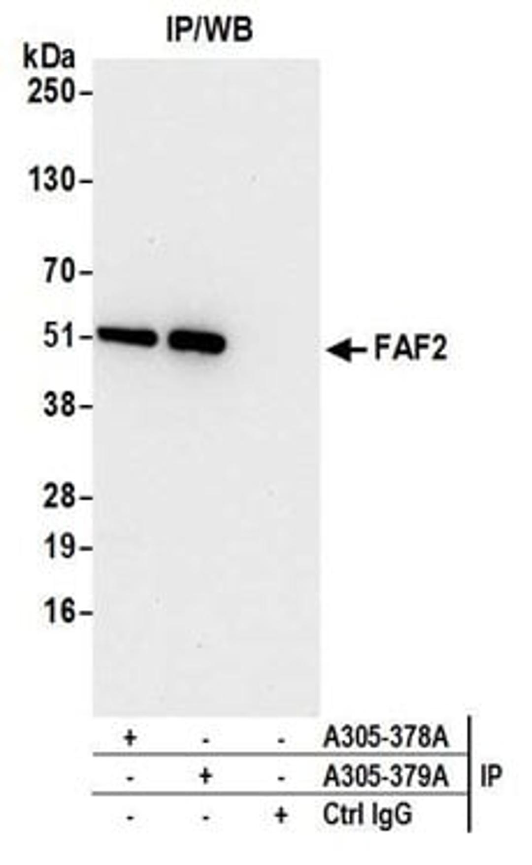 Detection of human FAF2 by western blot of immunoprecipitates.