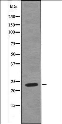 Western blot analysis of HeLa whole cell lysates using HAND1 -Phospho-Ser98- antibody