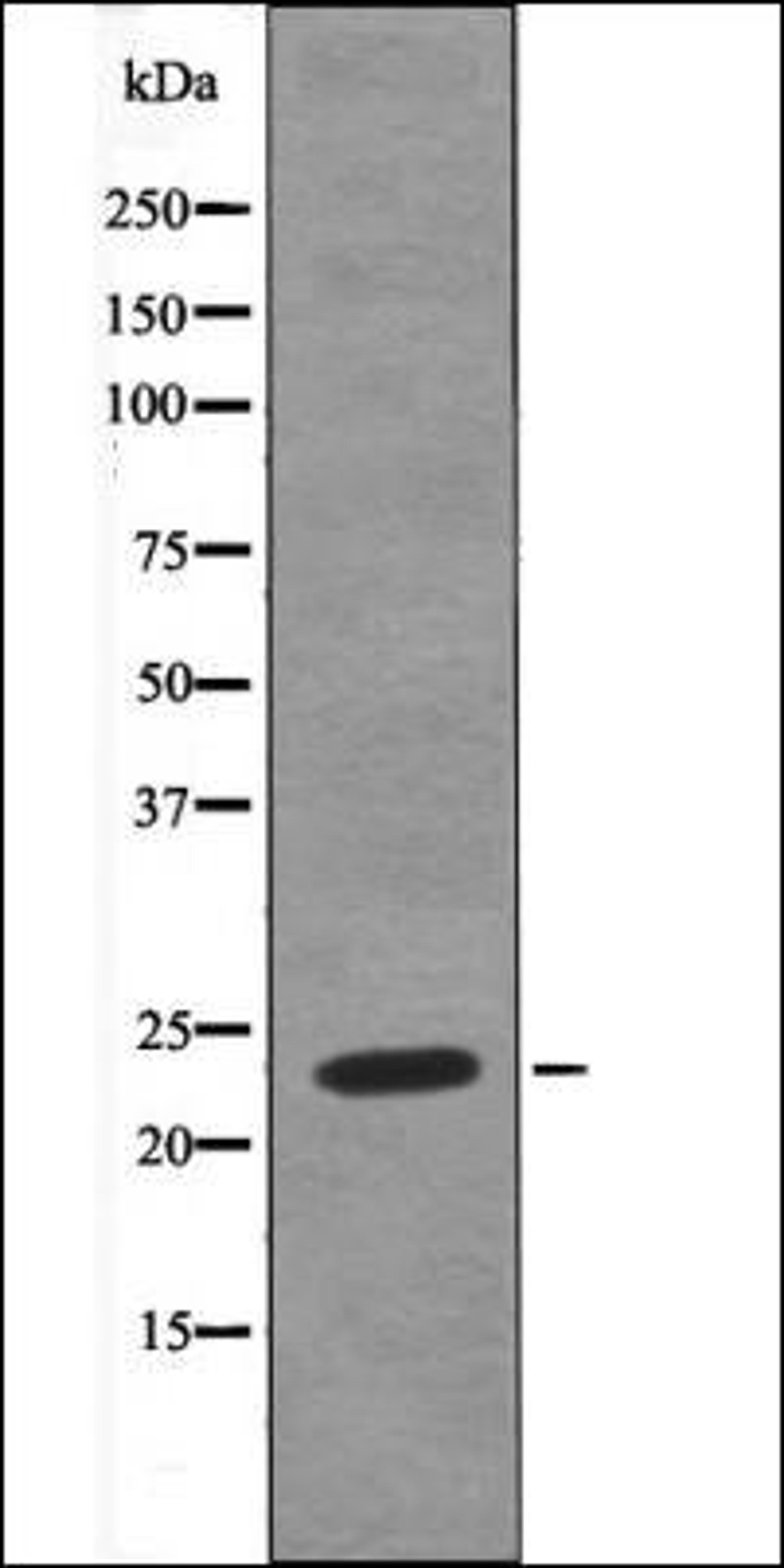 Western blot analysis of HeLa whole cell lysates using HAND1 -Phospho-Ser98- antibody