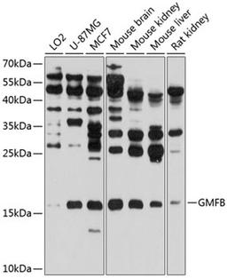 Western blot - GMFB antibody (A8652)