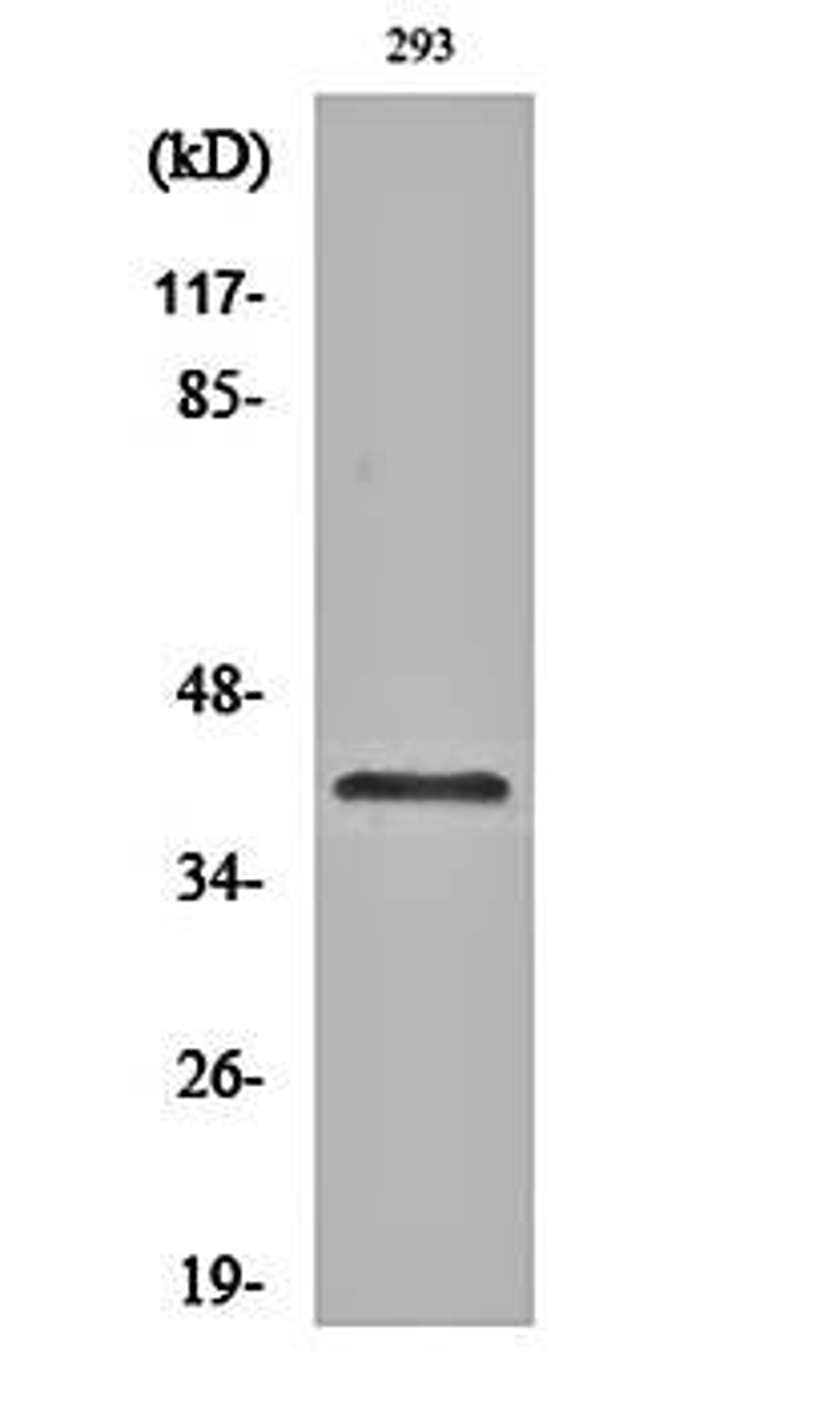 Western blot analysis of 293 cell lysates using Cleaved-Factor XII HC (R372) antibody