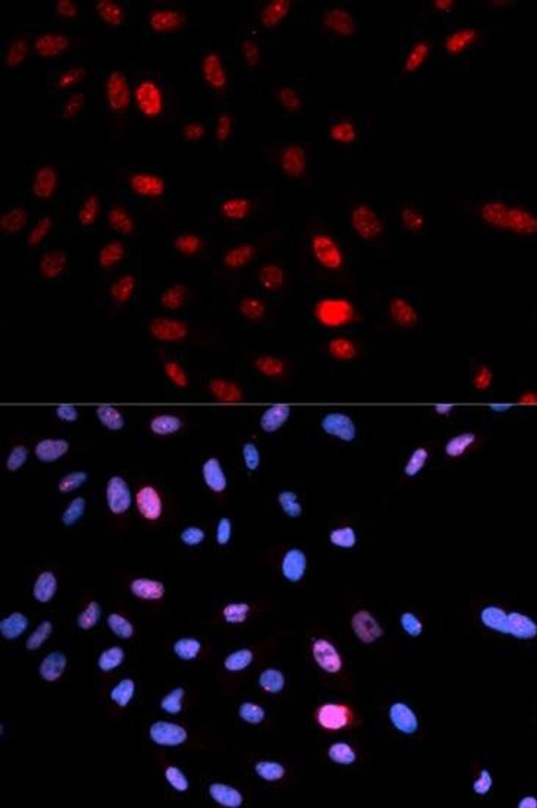 Immunofluorescense analysis of U2OS cell using SMC1A (phospho-Ser957) antibody