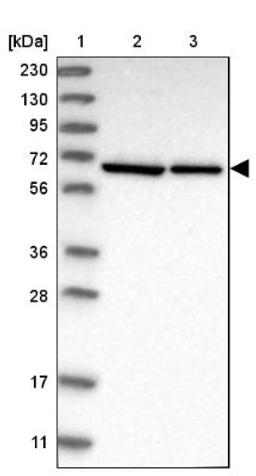 Western Blot: UTP6 Antibody [NBP1-88468] - Lane 1: Marker [kDa] 230, 130, 95, 72, 56, 36, 28, 17, 11<br/>Lane 2: Human cell line RT-4<br/>Lane 3: Human cell line U-251MG sp