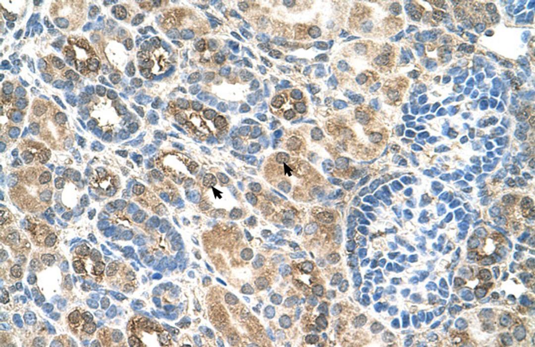 Antibody used in IHC on Human kidney.