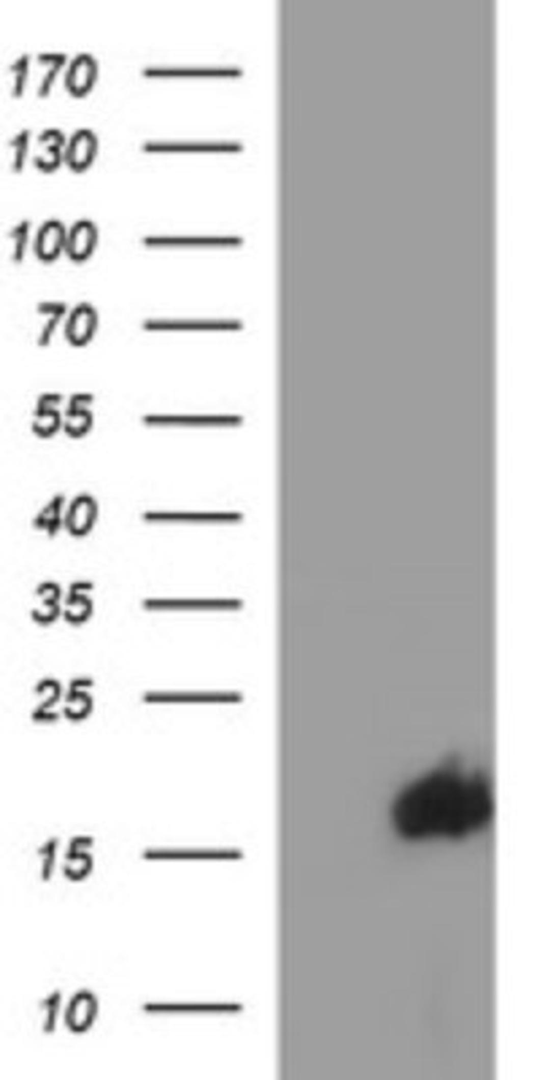 Western Blot: SIVA Antibody (2F8) [NBP2-45850] - Analysis of HEK293T cells were transfected with the pCMV6-ENTRY control (Left lane) or pCMV6-ENTRY SIVA.