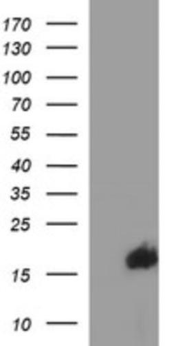 Western Blot: SIVA Antibody (2F8) [NBP2-45850] - Analysis of HEK293T cells were transfected with the pCMV6-ENTRY control (Left lane) or pCMV6-ENTRY SIVA.