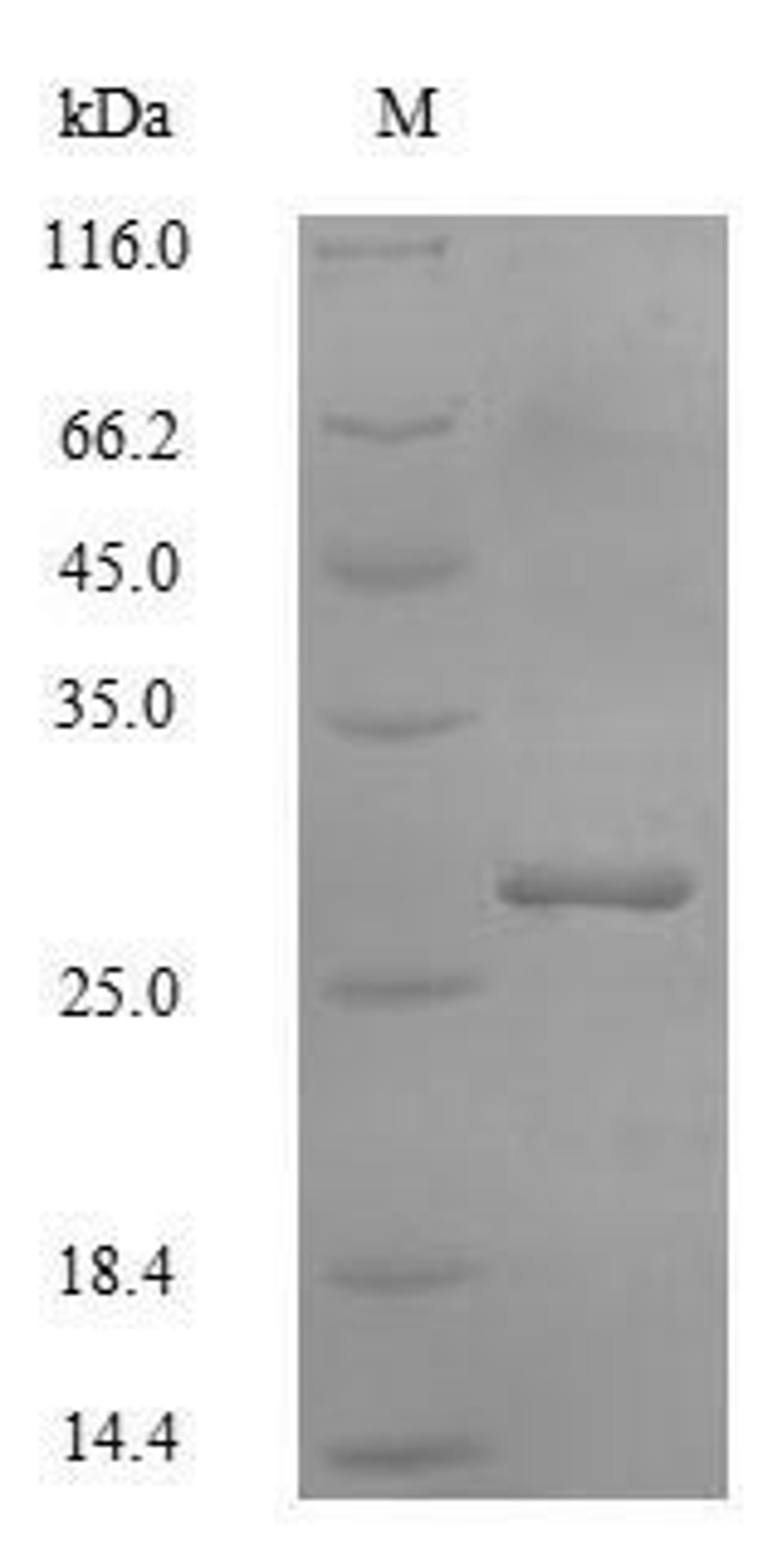 (Tris-Glycine gel) Discontinuous SDS-PAGE (reduced) with 5% enrichment gel and 15% separation gel.