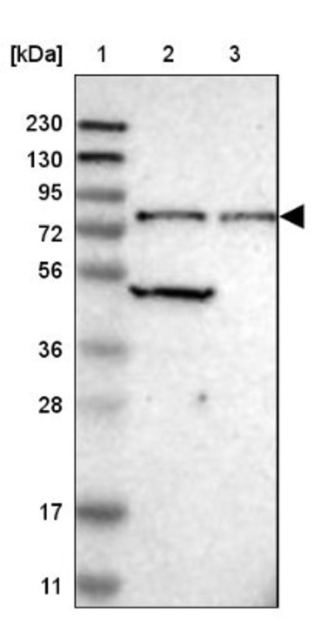 Western Blot: CTIF Antibody [NBP1-83007] - Lane 1: Marker [kDa] 230, 130, 95, 72, 56, 36, 28, 17, 11<br/>Lane 2: Human cell line RT-4<br/>Lane 3: Human cell line U-251MG sp