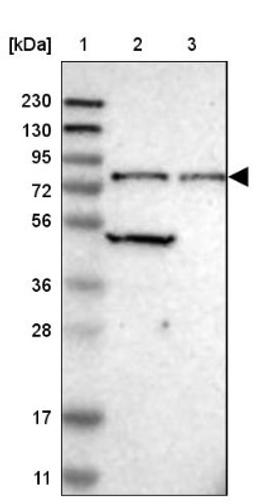 Western Blot: CTIF Antibody [NBP1-83007] - Lane 1: Marker [kDa] 230, 130, 95, 72, 56, 36, 28, 17, 11<br/>Lane 2: Human cell line RT-4<br/>Lane 3: Human cell line U-251MG sp