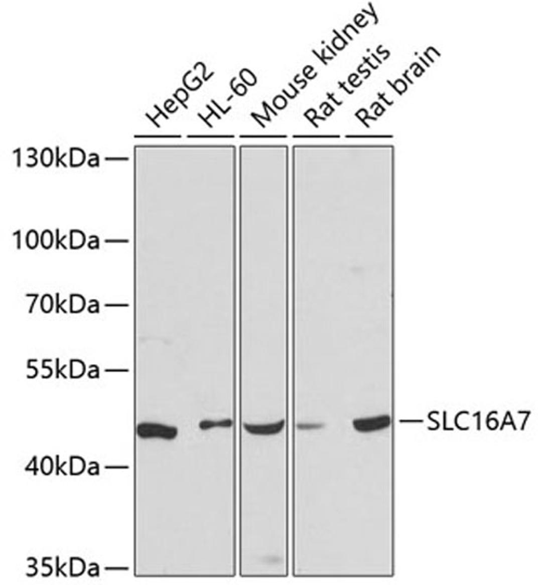 Western blot - SLC16A7 antibody (A12386)